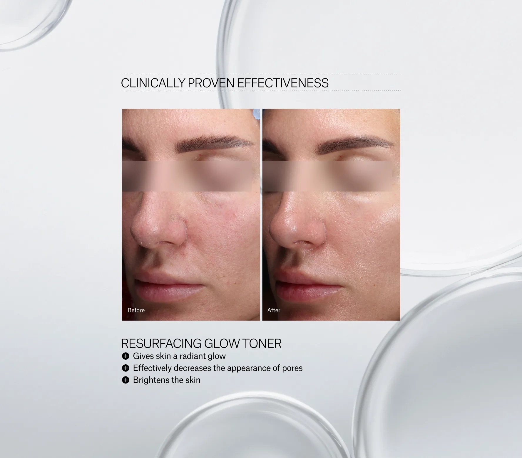 Resurfacing Glow Toner - Next-Gen