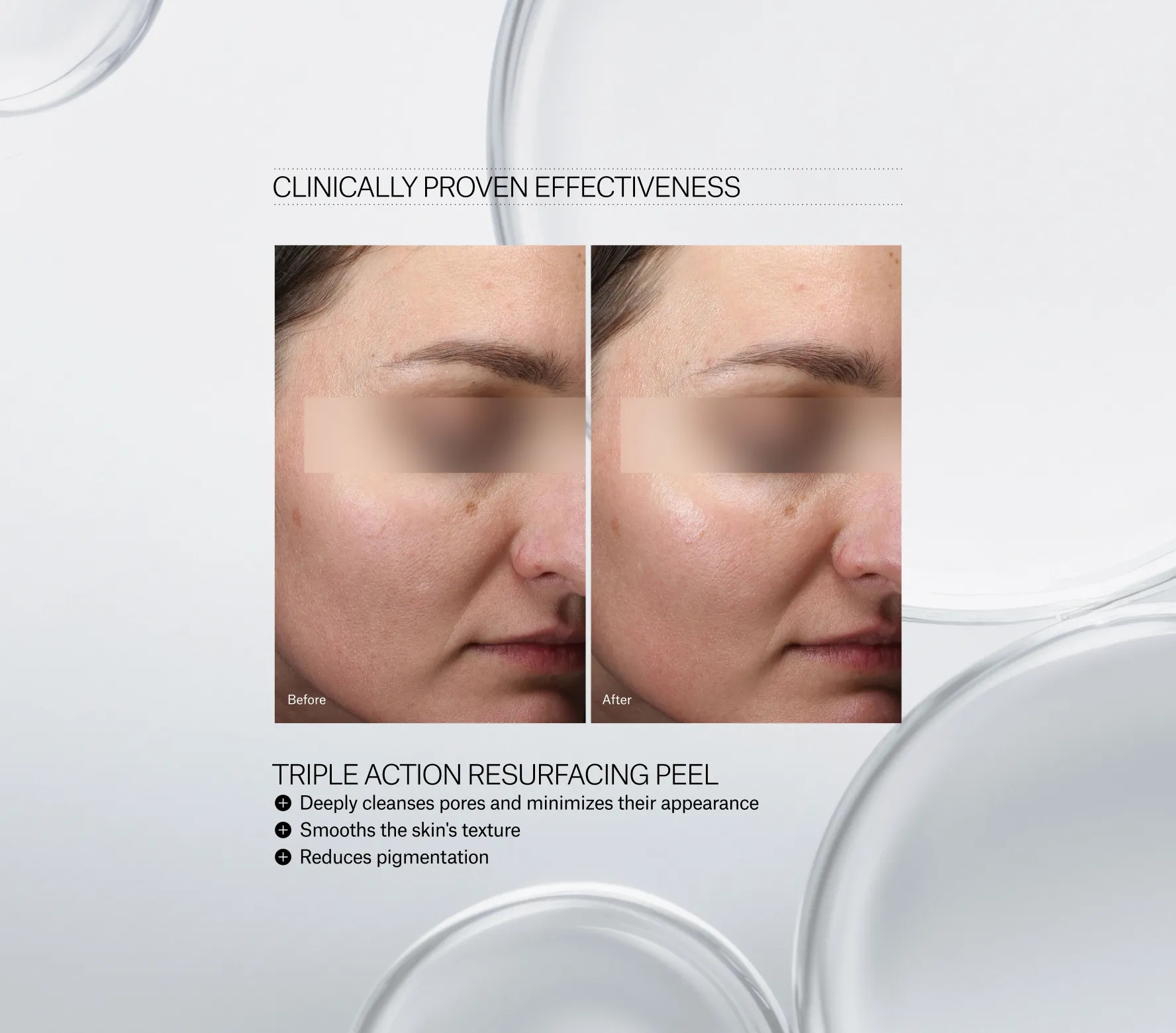 Triple Action Resurfacing Peel - Next-Gen