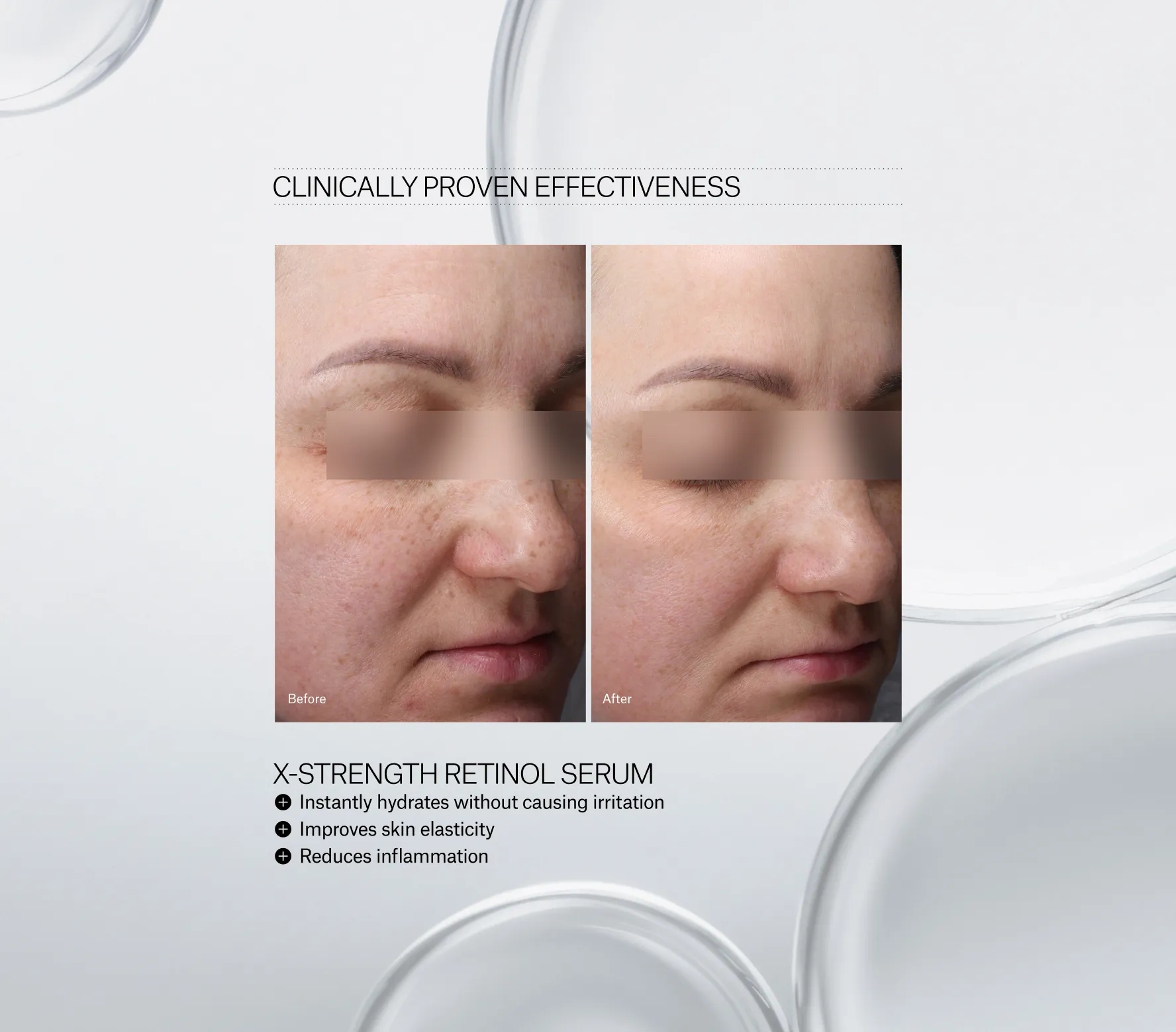 X-Strength Retinol Serum - Next-Gen