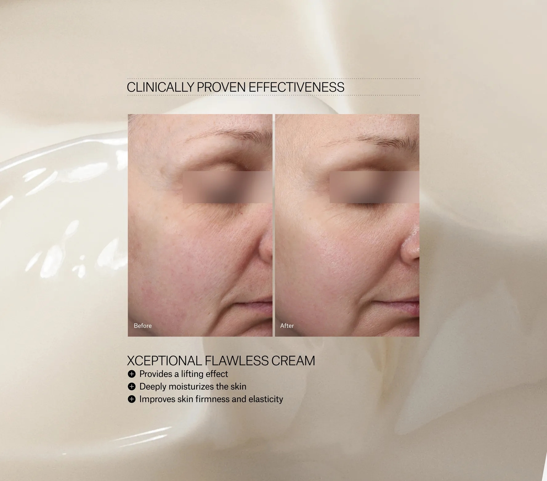 Xceptional Flawless Cream - Next-Gen