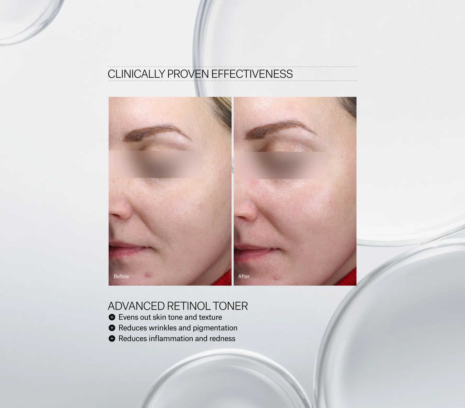 Advanced Retinol Toner - Next-Gen