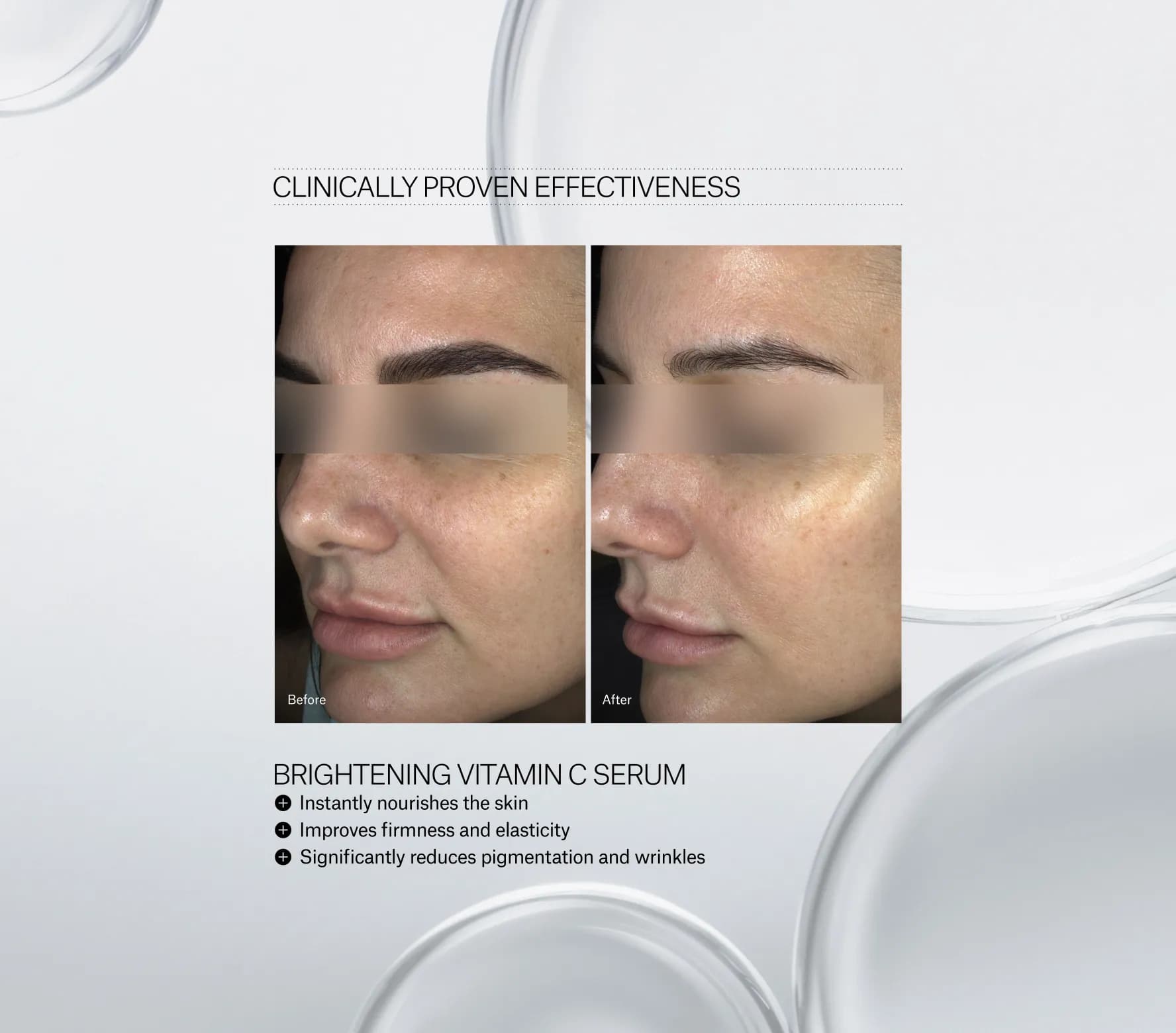 Brightening Vitamin C Serum - Next-Gen