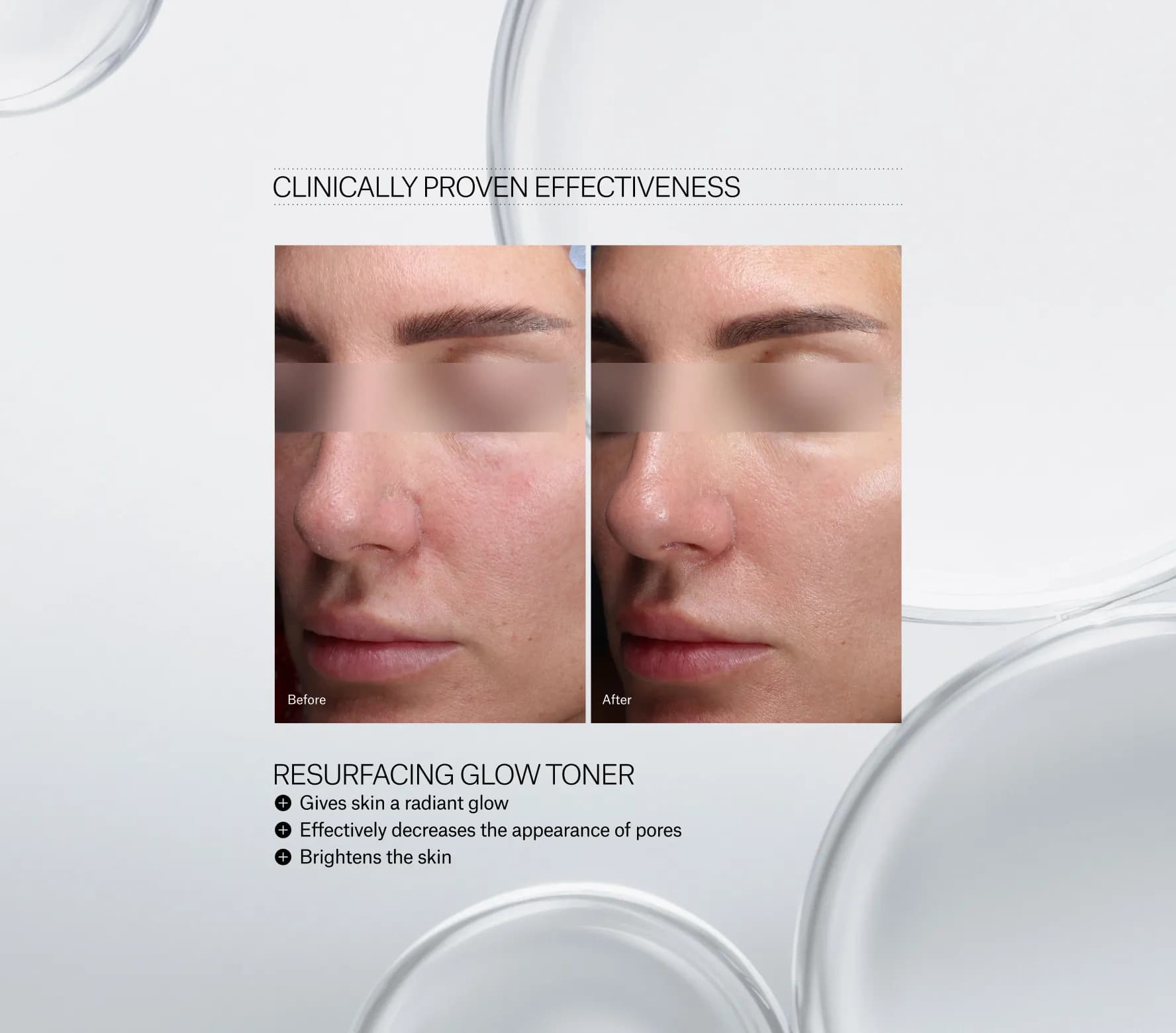 Resurfacing Glow Toner - Next-Gen