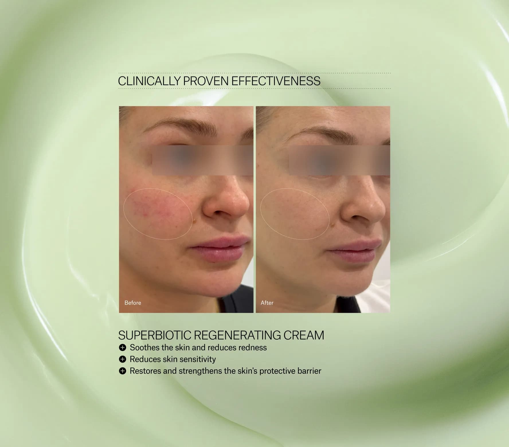 SuperBiotic Regenerating Cream - Next-Gen