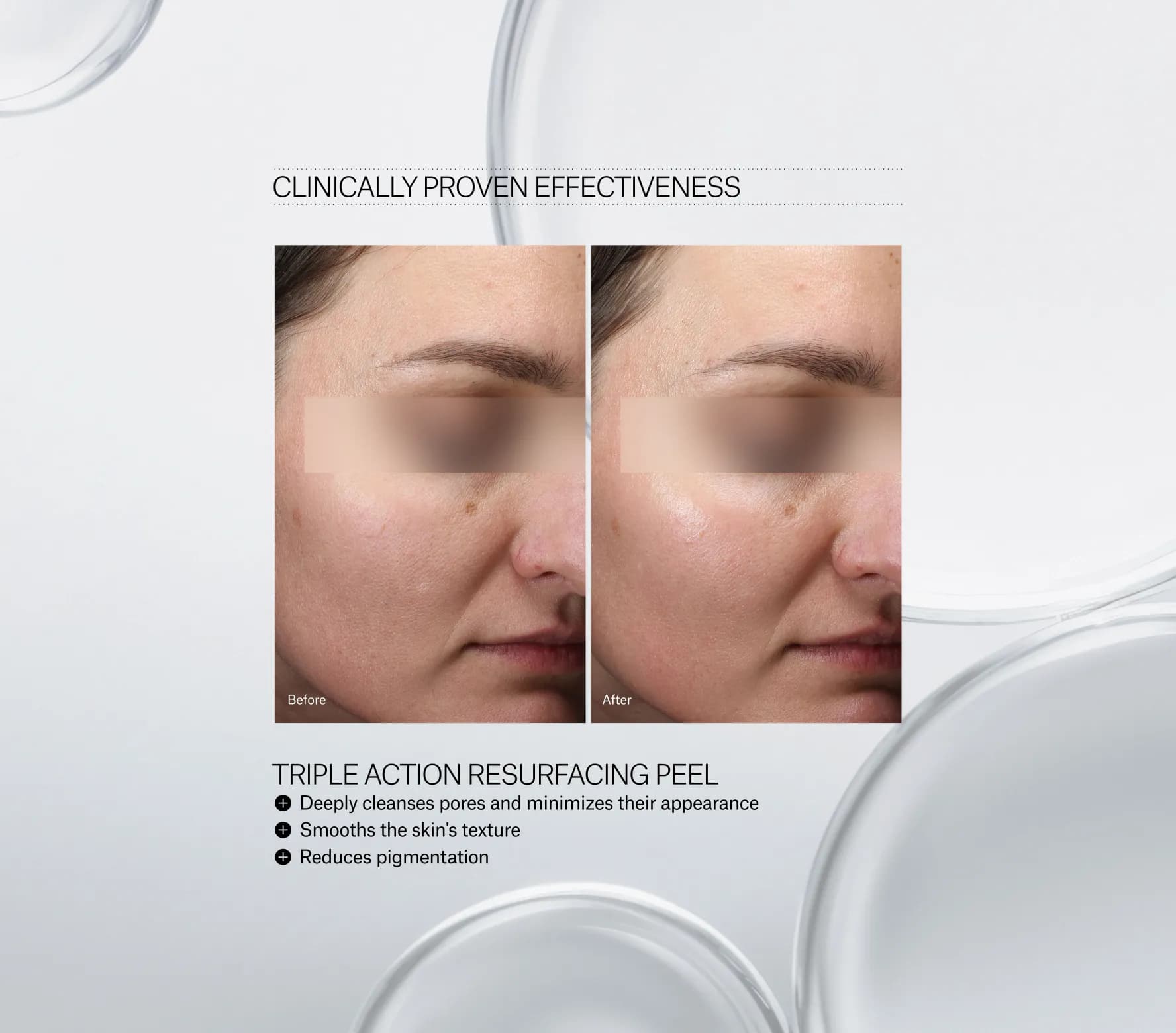 Triple Action Resurfacing Peel - Next-Gen