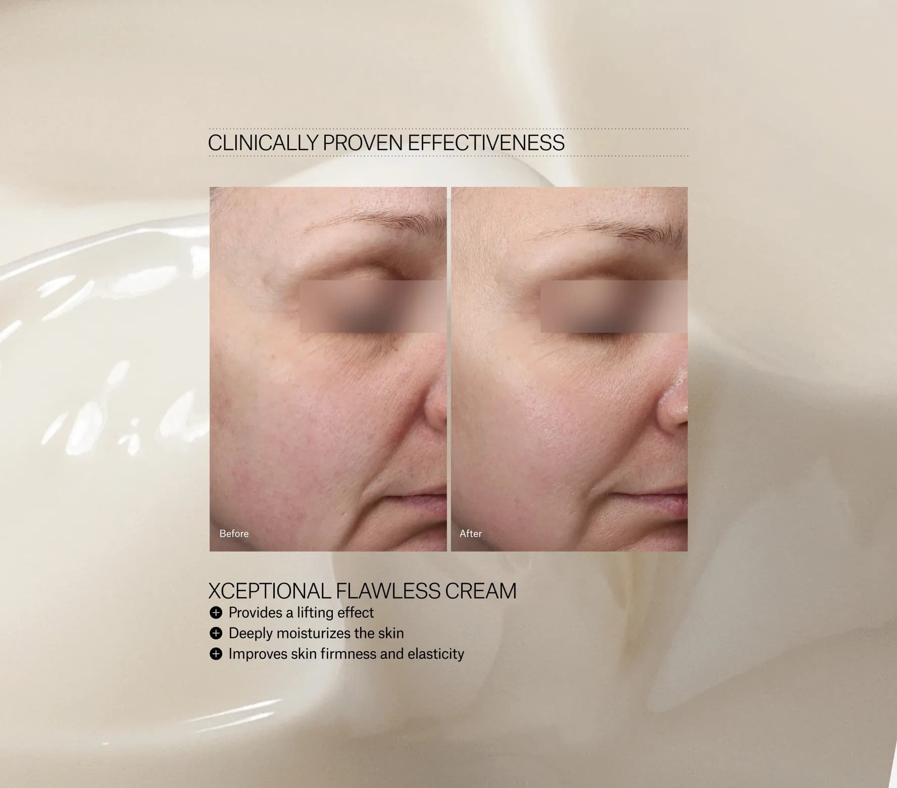 Xceptional Flawless Cream - Next-Gen