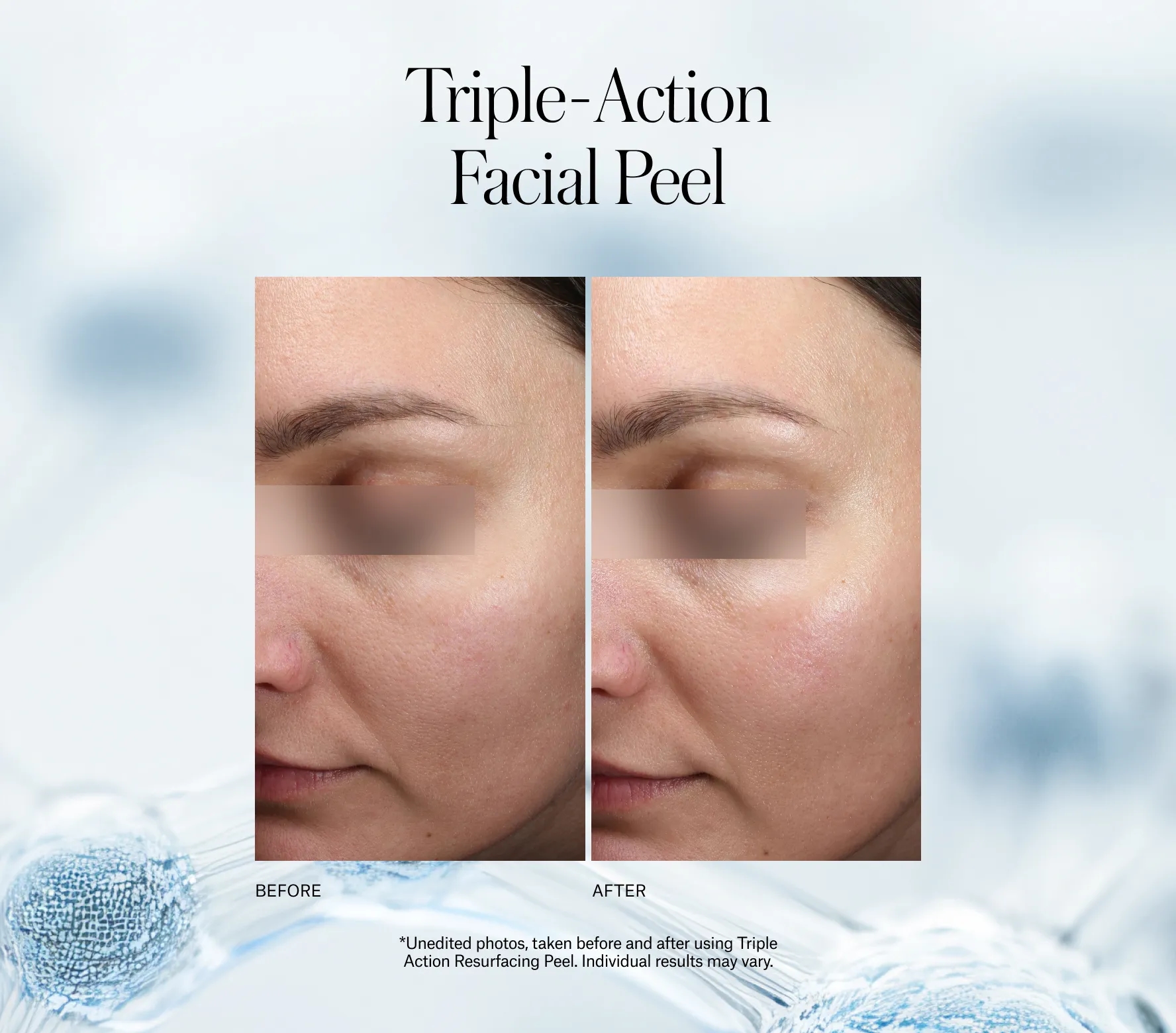 Triple Action Resurfacing Peel - Next-Gen