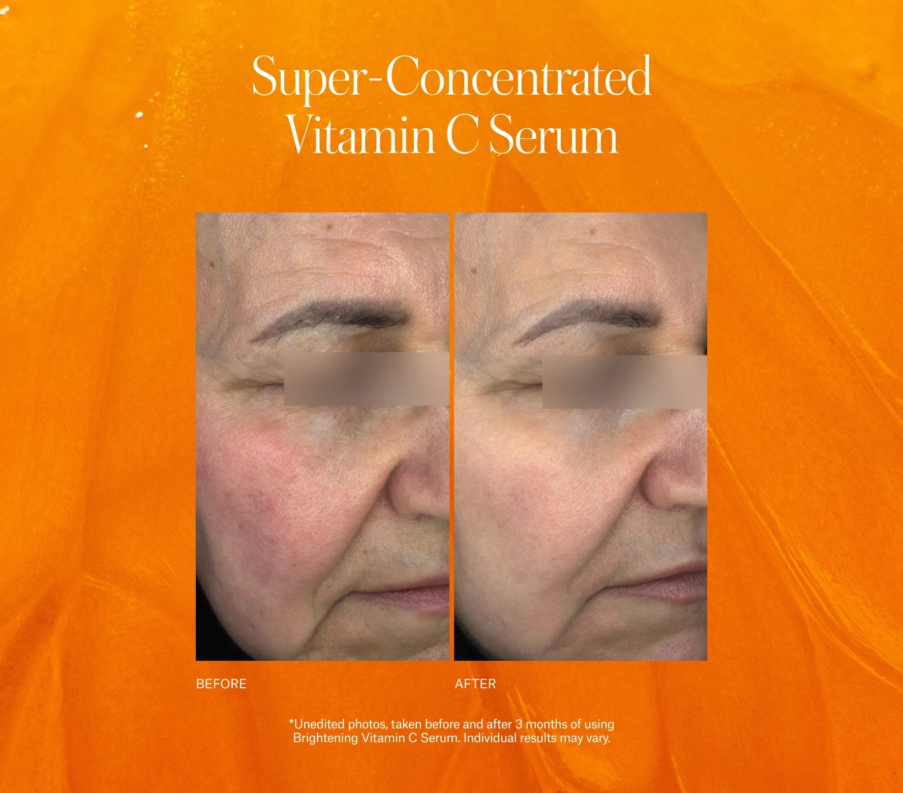 Brightening Vitamin C Serum - Next-Gen