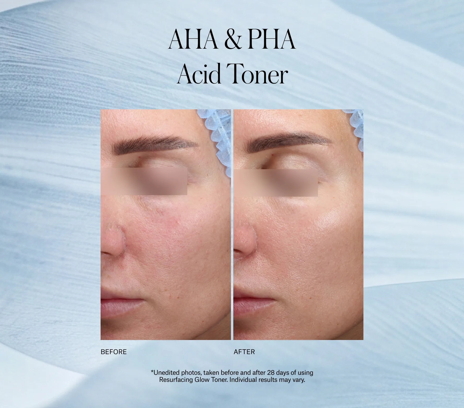 Resurfacing Glow Toner - Next-Gen
