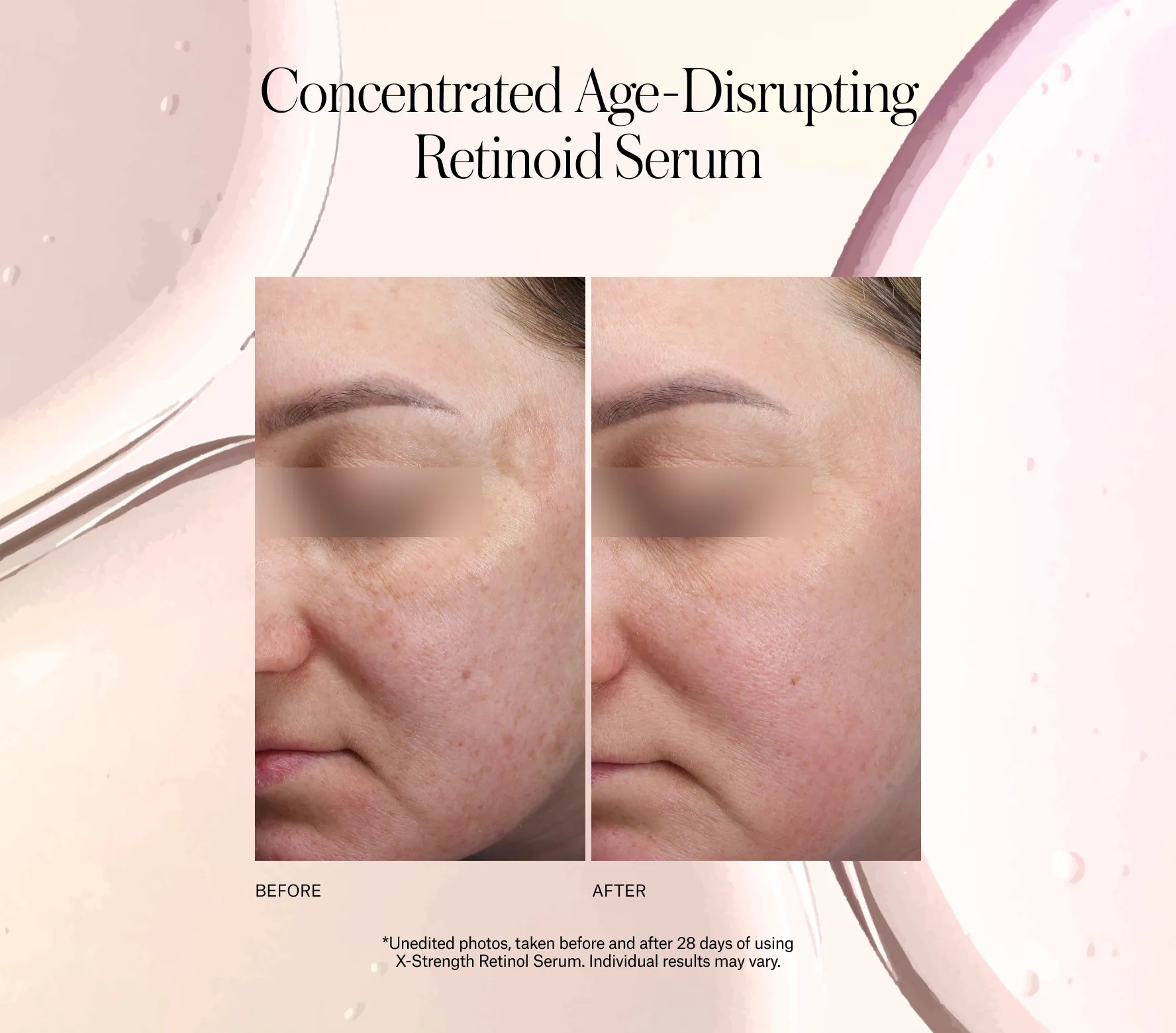 X-strength Retinol Serum Copy(2026-01-09)
