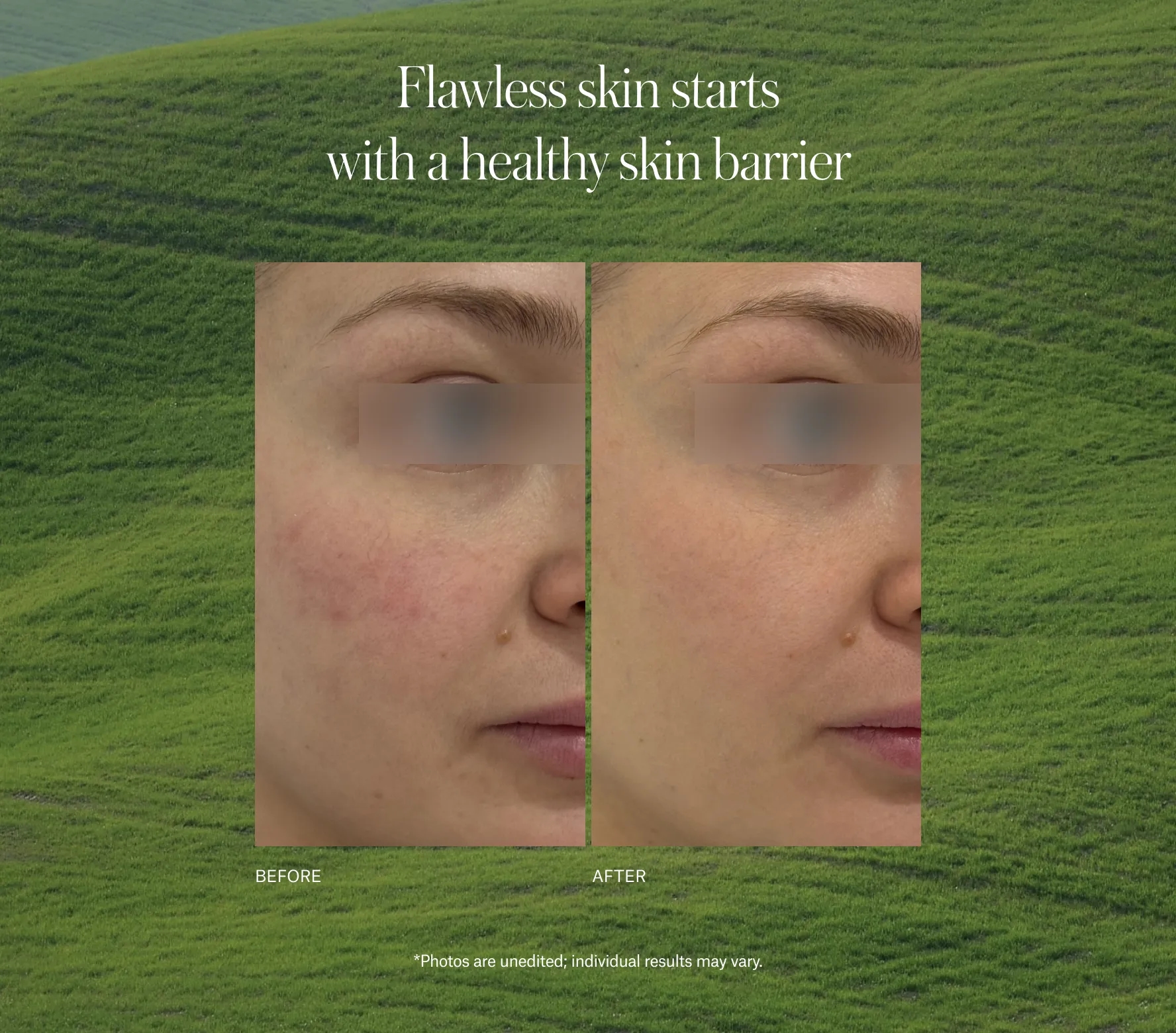 SuperBiotic Regenerating Cream - Next-Gen