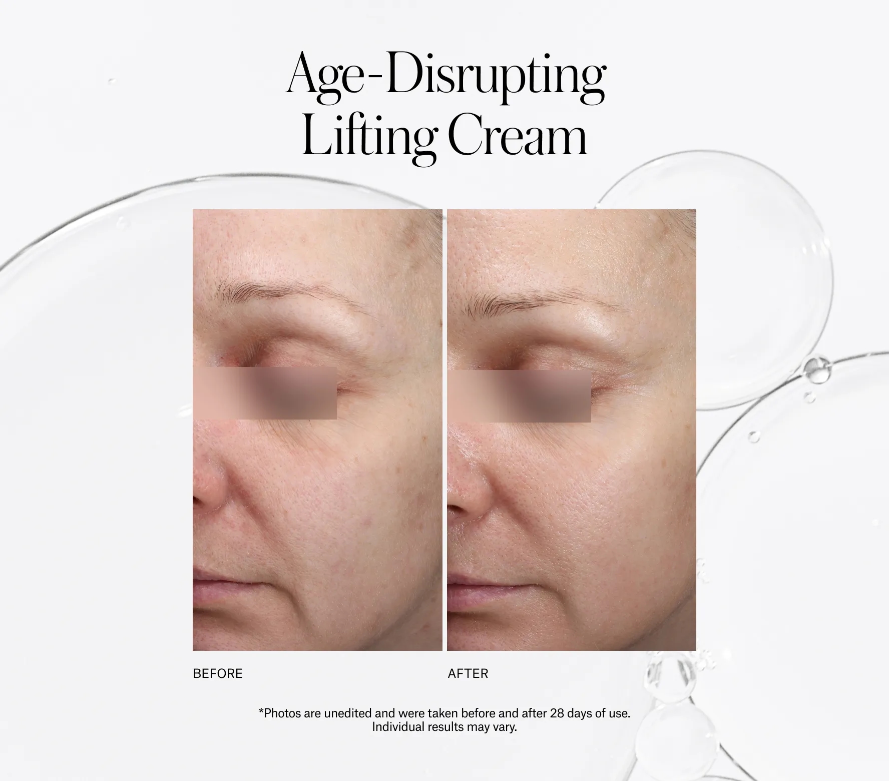 Xceptional Flawless Cream - Next-Gen