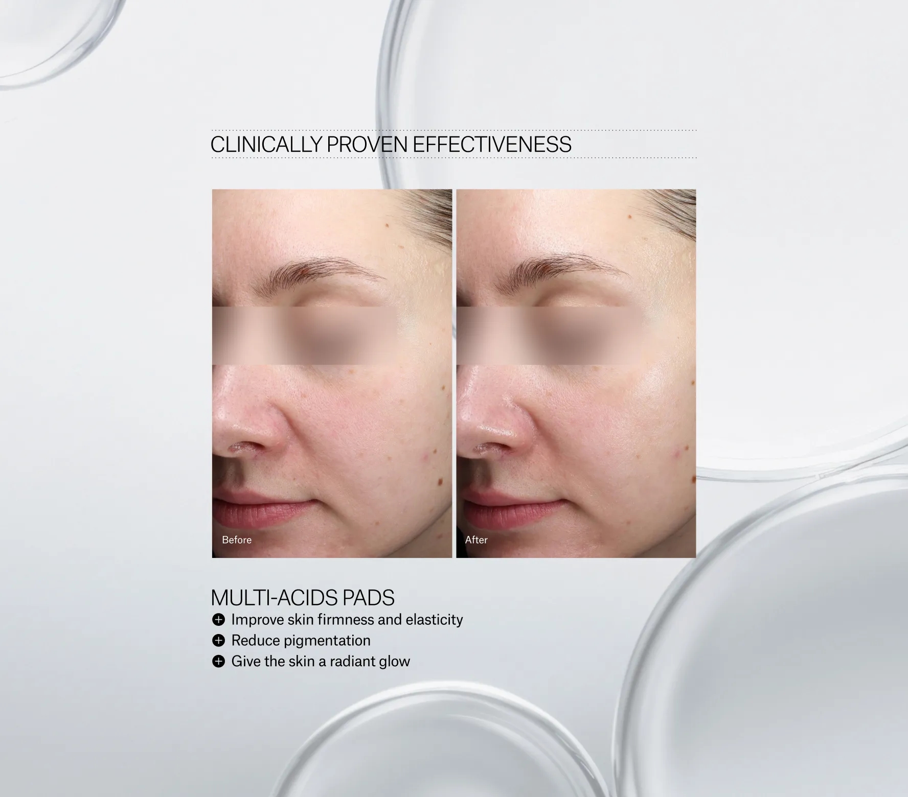 Resurfacing Multi-Acids Pads - Next-Gen