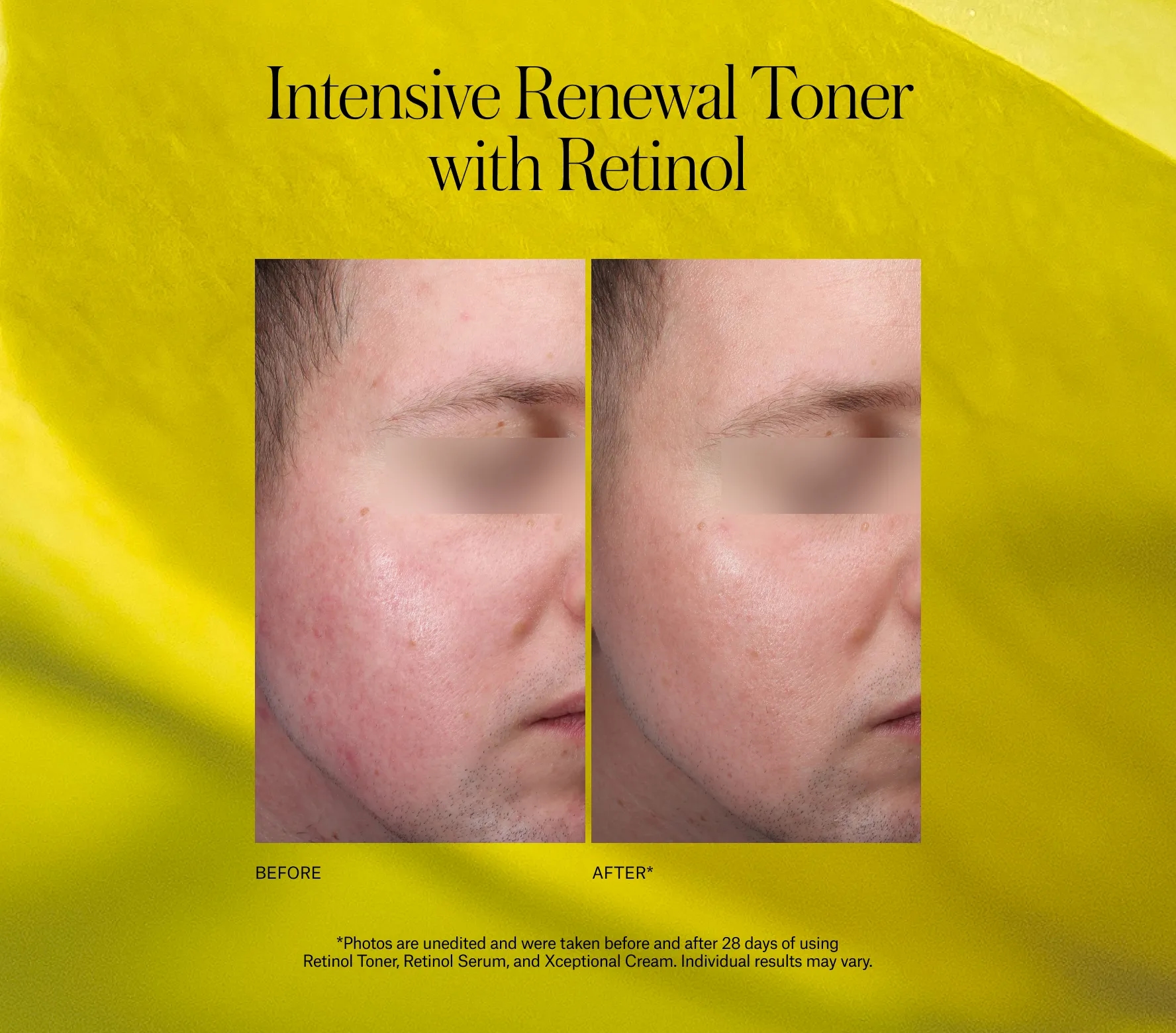 Advanced Retinol Toner - Next-Gen