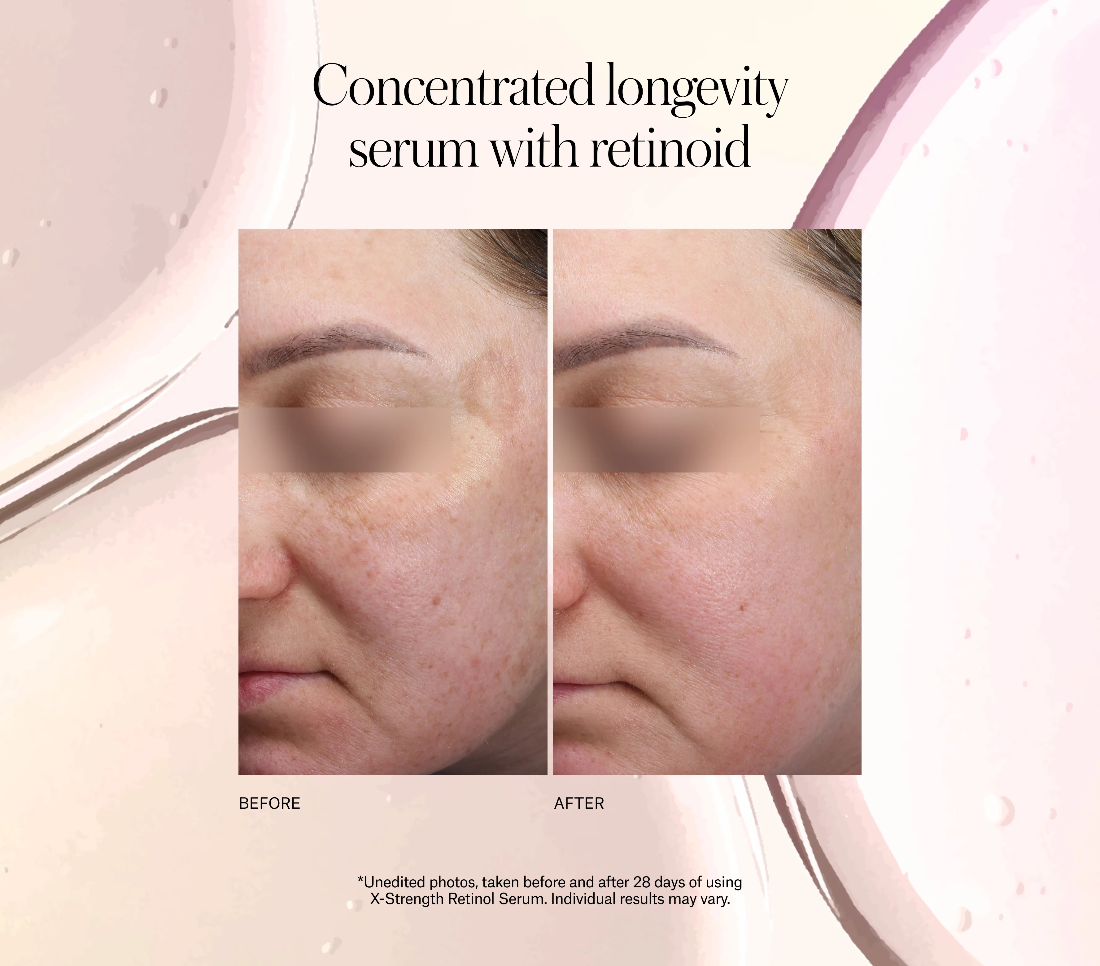 X-Strength Retinol Serum - Next-Gen