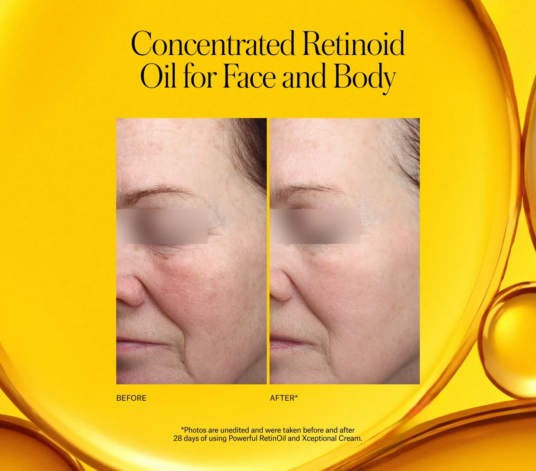 Powerful RetinOil - Next-Gen