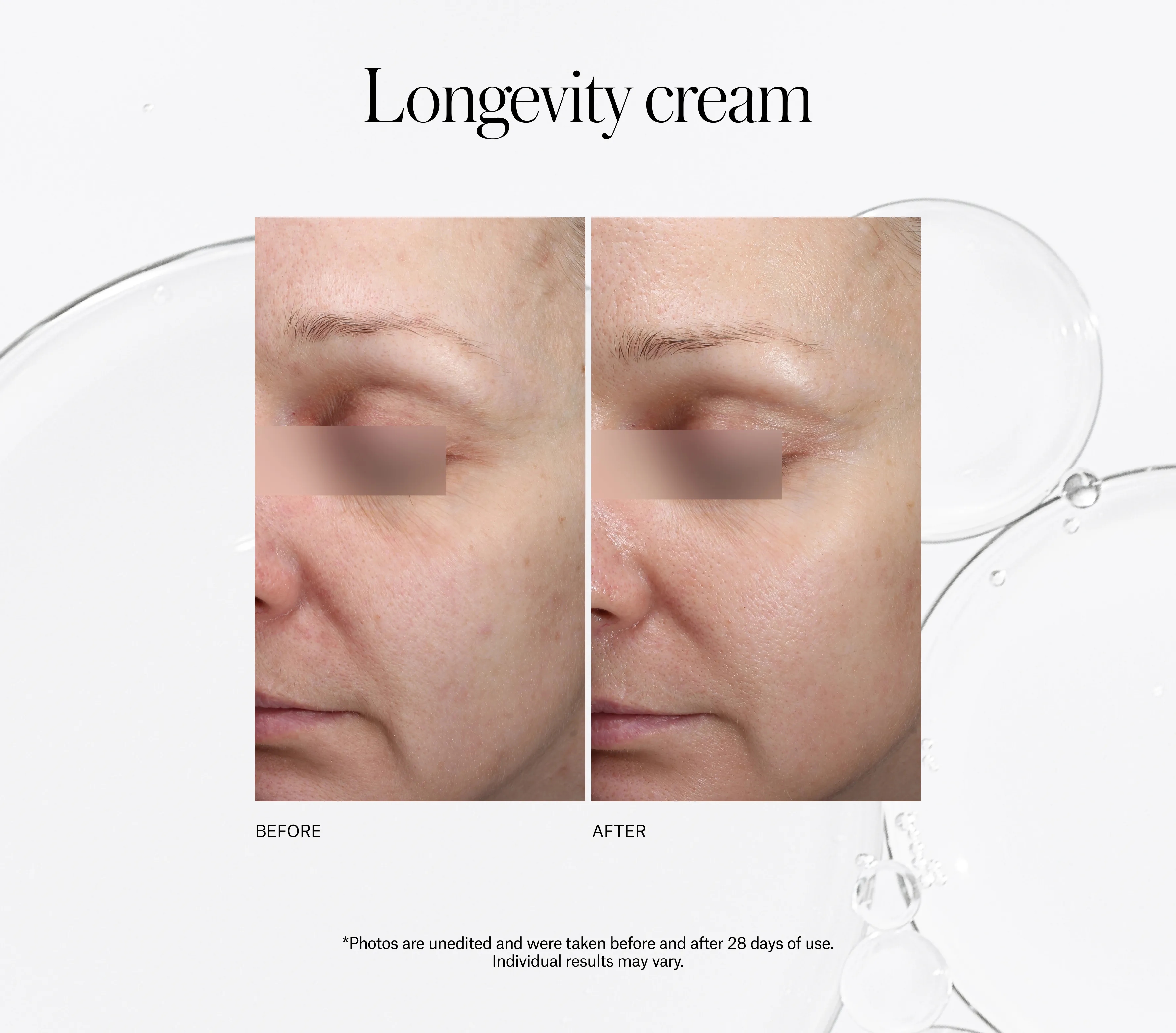 Xceptional Flawless Cream - Next-Gen