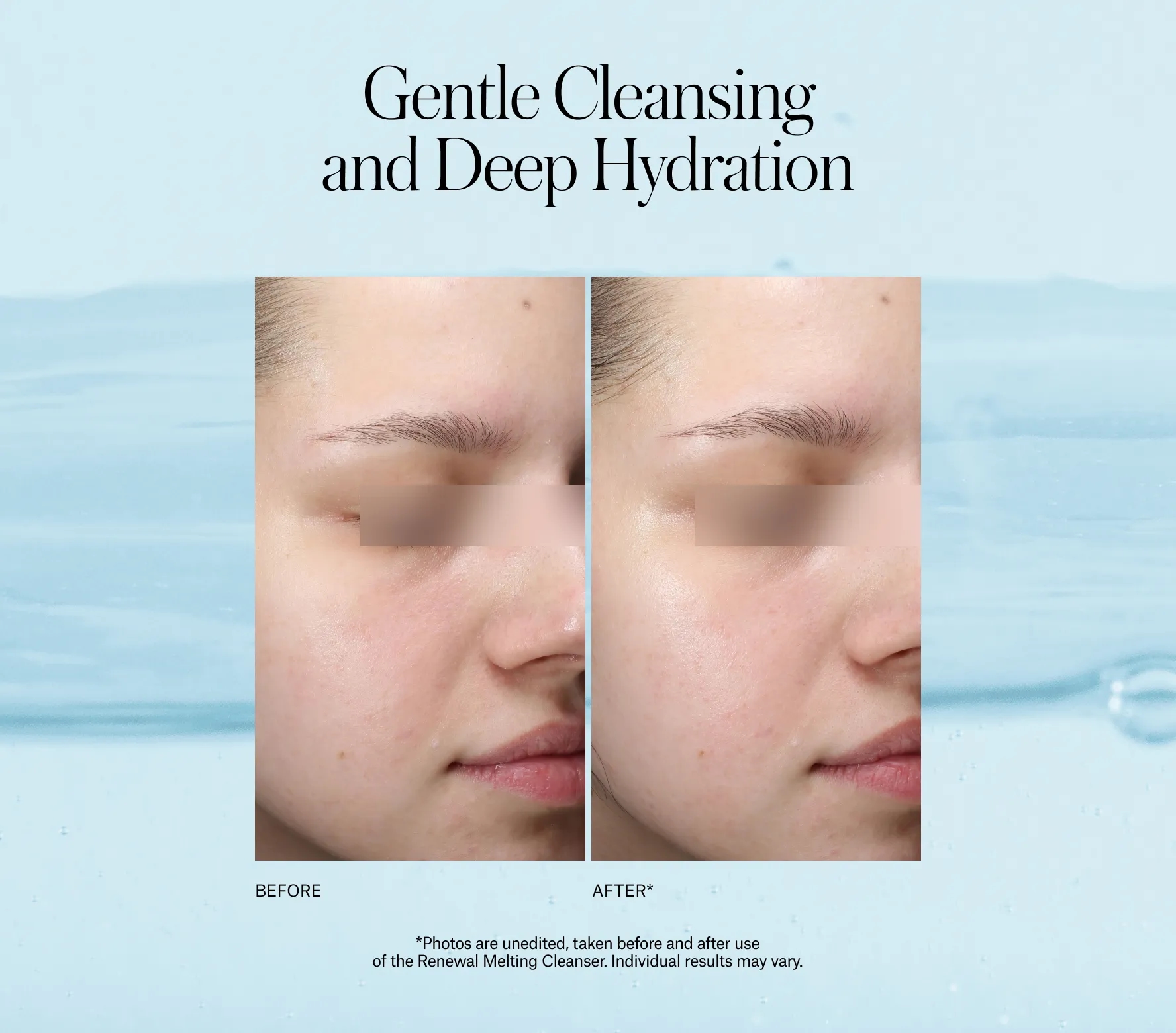 Renewal Melting Cleanser - Next-Gen
